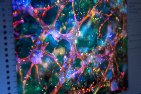 Immunostained neuron stem cells